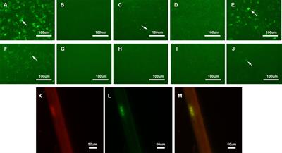 Anti-rituximab antibodies in patients with refractory autoimmune nodopathy with anti-neurofascin-155 antibody